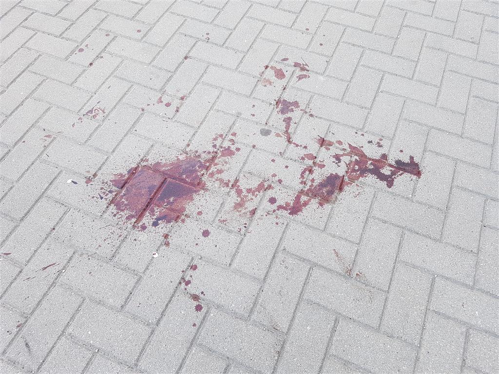 Rzecznik olsztyńskiej policji zaatakowany szklaną butelką. Ma pękniętą podstawę czaszki