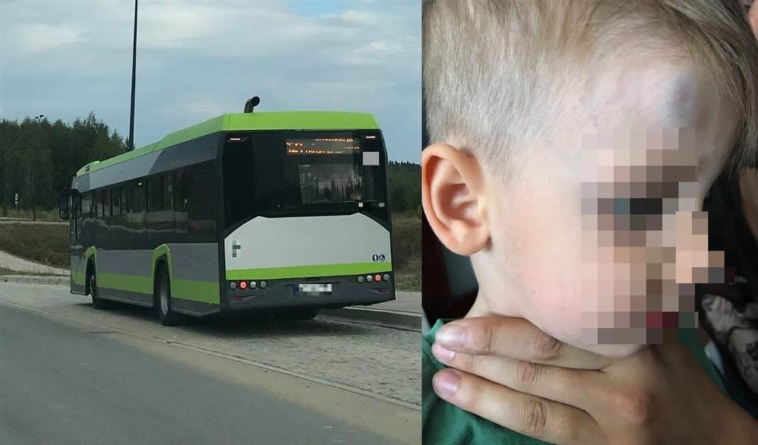 Chłopiec uderzył głową w biletomat. „Kierowca miał to gdzieś”. Czy w olsztyńskich autobusach jeździ się bezpiecznie?