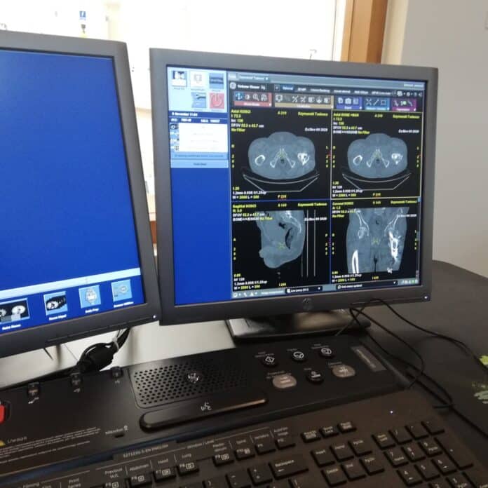 Pacjenci pójdą na tomografię ze zwykłym skierowaniem Wiadomości, Olsztyn