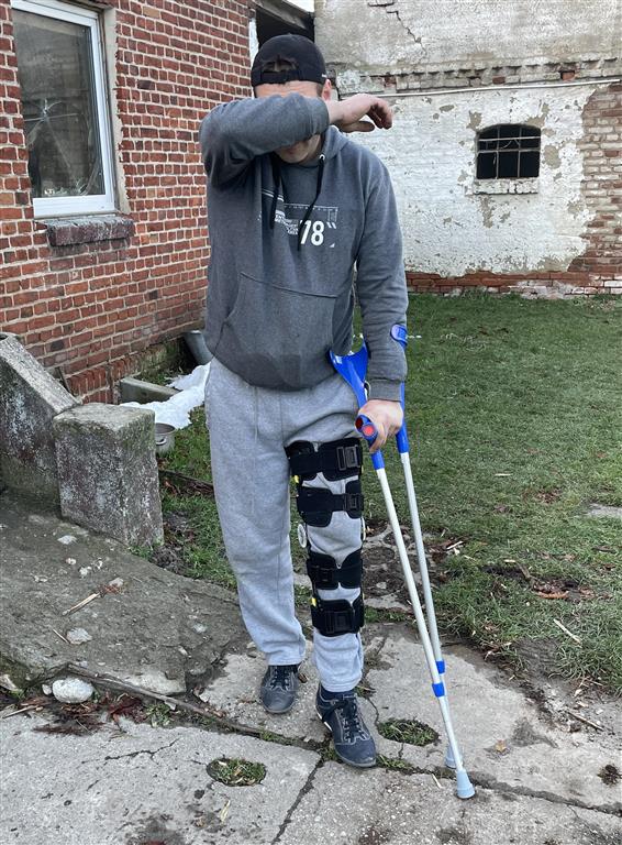 Sześciu wyrostków zaatakowało niepełnosprawnego. Obrońca prawie nie stracił nogi od ciosu maczetą