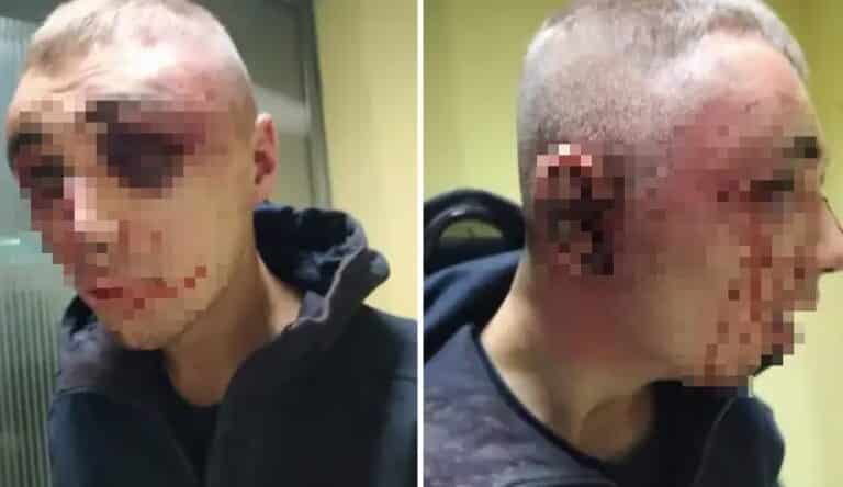 Zatrzymano dwie osoby, które pobiły i okradły DJ-a na dworcu. Wiadomo jaka grozi im kara