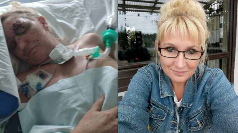 Tir zmiótł jej samochód z drogi. Iwona potrzebuje leczenia i rehabilitacji