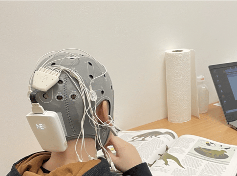 Centrum Neuroterapii Rutkowscy - Mikropolaryzacja mózgu TDCS