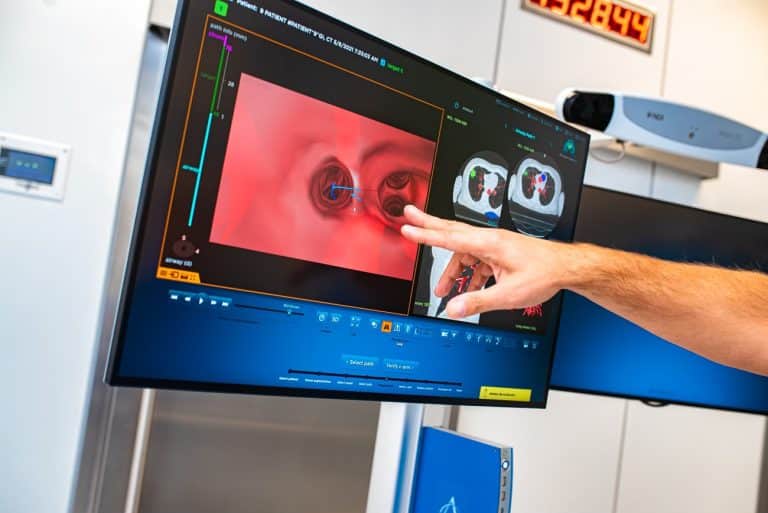 Nowoczesny sprzęt diagnostyczny w olsztyńskim szpitalu dzięki wsparciu ze zbi&oacute;rek