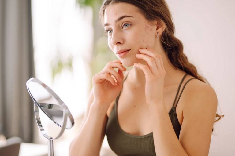 Najskuteczniejsze metody usuwania blizn potrądzikowych – laser, peelingi, a może dermabrazja?