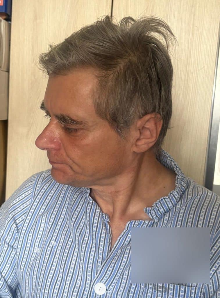 Pacjent widmo w Olsztynie! Mówi, ale milczy o sobie. - Śledztwo policji w olsztyńskim szpitalu. Pacjent skrywa wielką tajemnicę