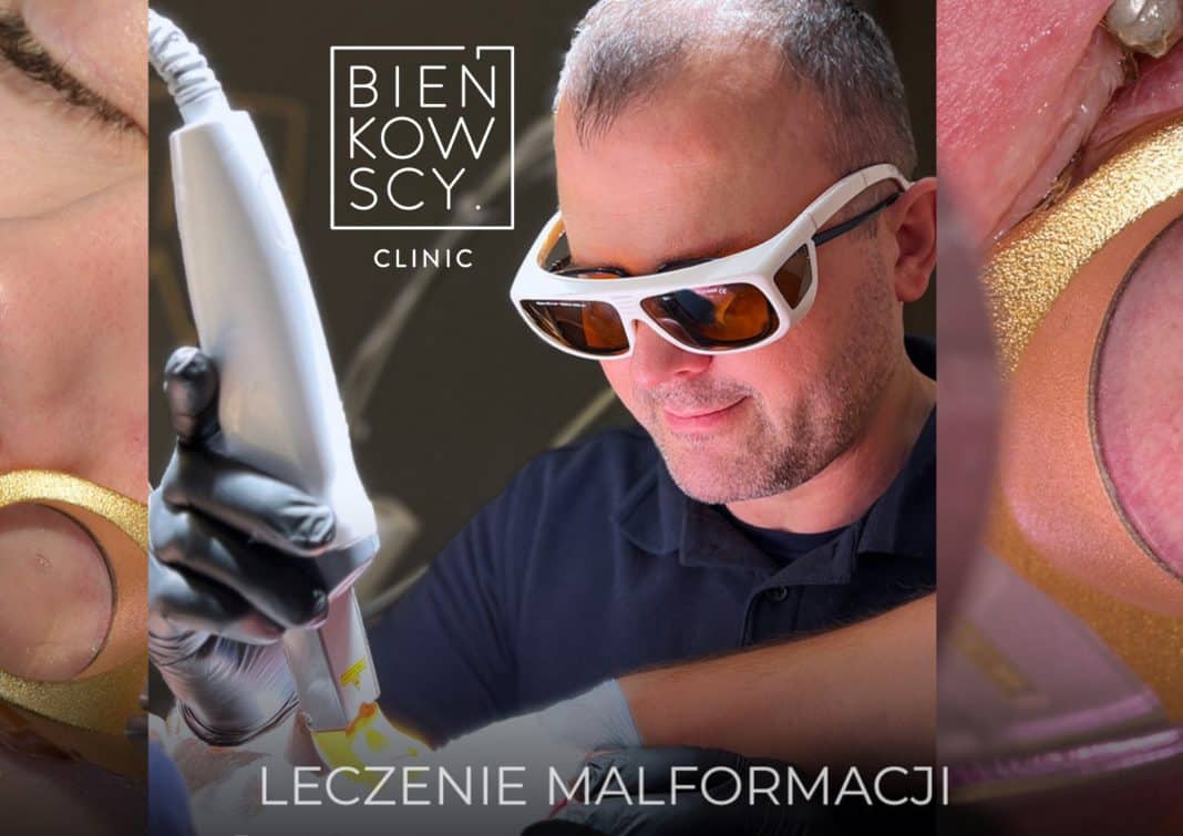 Malformacje naczyniowe &ndash; jak nowoczesna medycyna estetyczna zmienia życie pacjent&oacute;w?