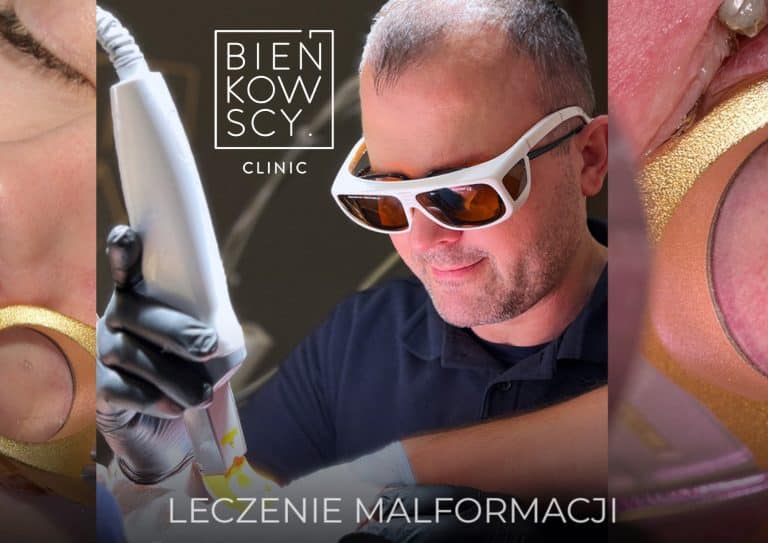 Malformacje naczyniowe &ndash; jak nowoczesna medycyna estetyczna zmienia życie pacjent&oacute;w?