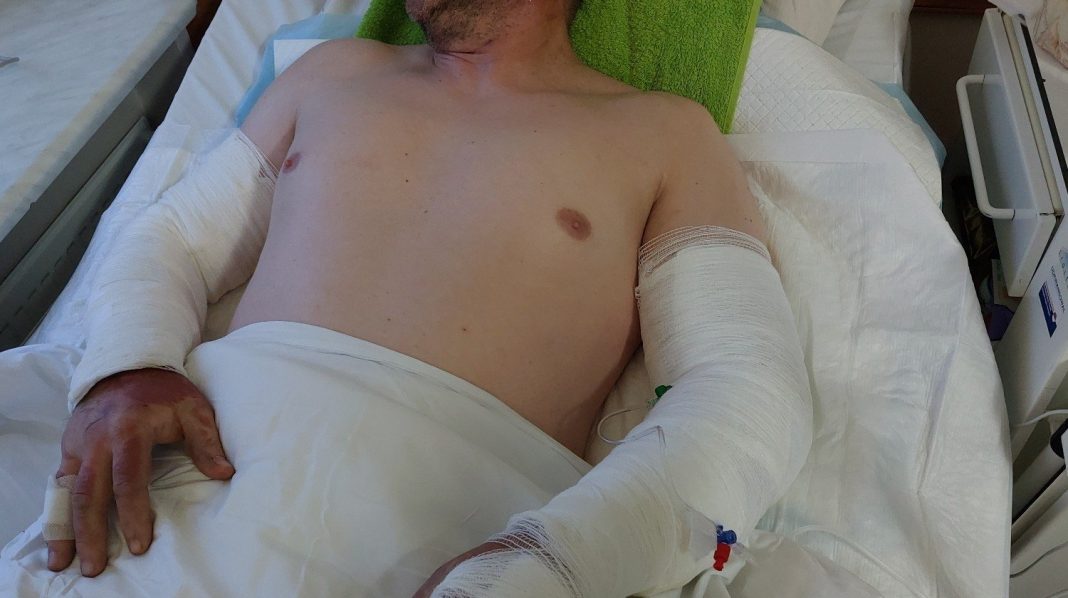 strażak potrzebuje pomocy