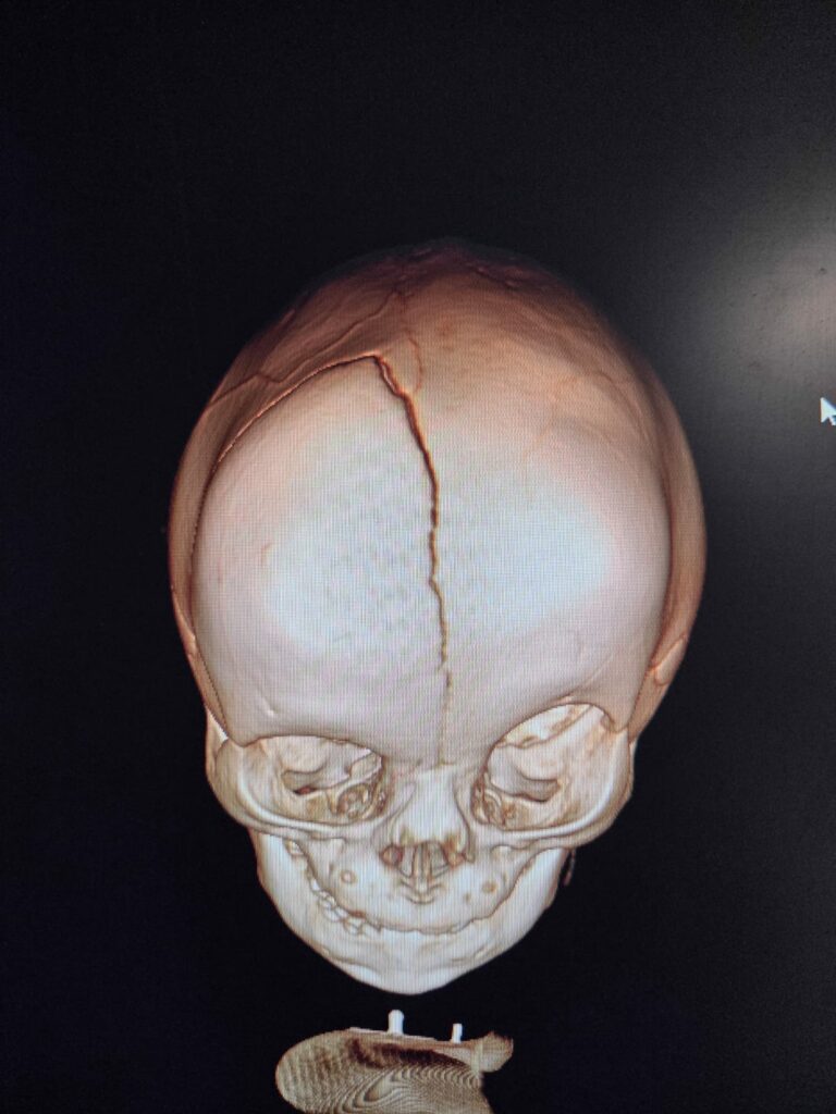 Olsztyński szpital wśród najlepszych w Europie. - To dzieje się w Olsztynie! Lekarze leczą dzieci metodą, której nie ma nikt inny w Polsce