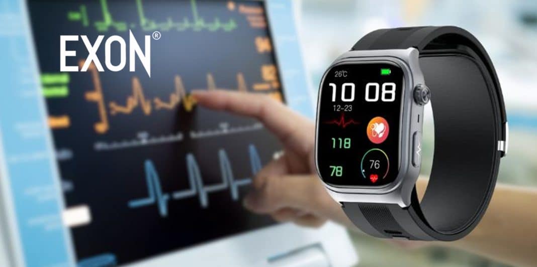 Zegarek z EKG: jak działa pomiar i czy jest wiarygodny?