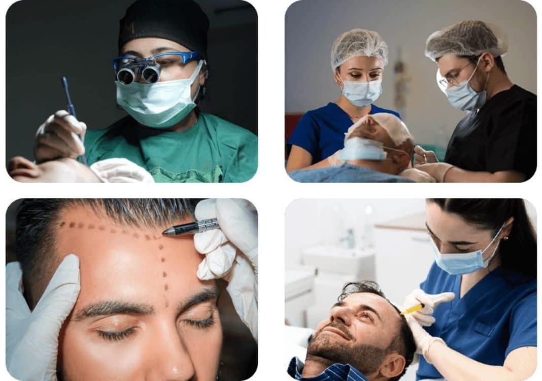 Zesp&oacute;ł lekarzy i specjalist&oacute;w wykonujących zabiegi przeszczepu włos&oacute;w w klinice medycznej.