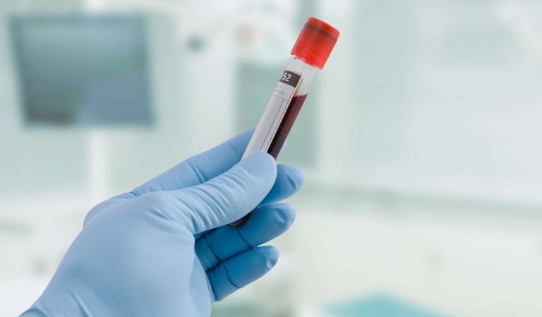 Laboratorium medyczne z pobraniem krwi, ręka w rękawiczce jednorazowej.