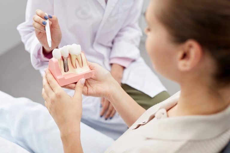 Model przedstawiający implant zęba i protezę, używany do edukacji pacjentów w gabinecie stomatologicznym.